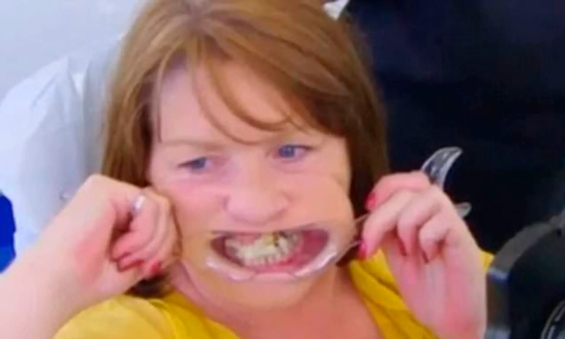 What Happens If You Get Super Glue In Your Mouth
