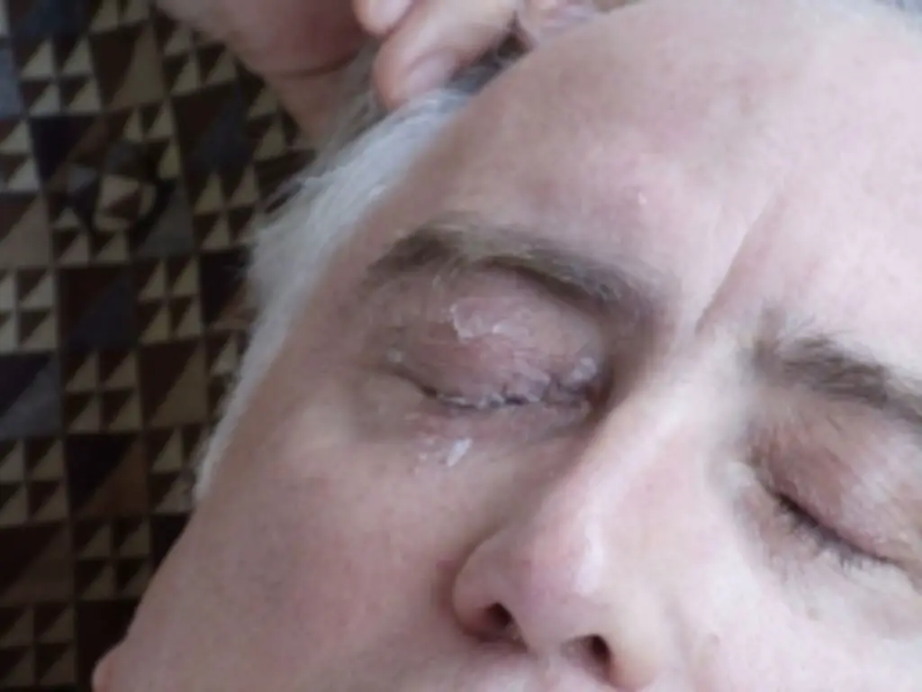 What To Do If Super Glue Gets In Your Eye